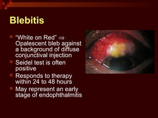 Blebitis
 “White on Red” ⇒
Opalescent bleb against
a background of diffuse
conjunctival injection
 Seidel test is often
positive
 Responds to therapy
within 24 to 48 hours
 May represent an early
stage of endophthalmitis
 