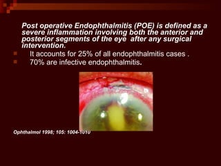 Post operative Endophthalmitis (POE) is defined as a
severe inflammation involving both the anterior and
posterior segments of the eye after any surgical
intervention.
 It accounts for 25% of all endophthalmitis cases .
 70% are infective endophthalmitis.
Ophthalmol 1998; 105: 1004-1010
 