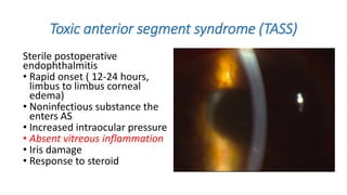 Toxic anterior segment syndrome (TASS)
Sterile postoperative
endophthalmitis
• Rapid onset ( 12-24 hours,
limbus to limbus corneal
edema)
• Noninfectious substance the
enters AS
• Increased intraocular pressure
• Absent vitreous inflammation
• Iris damage
• Response to steroid
 