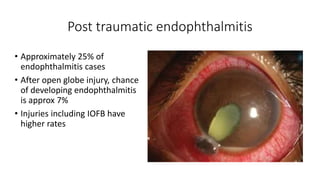 Post traumatic endophthalmitis
• Approximately 25% of
endophthalmitis cases
• After open globe injury, chance
of developing endophthalmitis
is approx 7%
• Injuries including IOFB have
higher rates
 