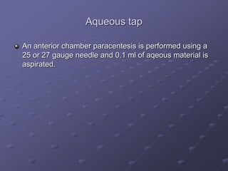 Aqueous tap
An anterior chamber paracentesis is performed using a
25 or 27 gauge needle and 0.1 ml of aqeous material is
aspirated.
 