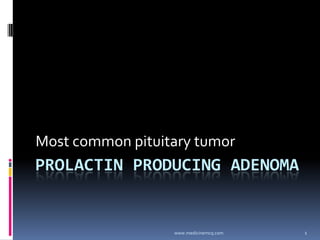 1
PROLACTIN PRODUCING ADENOMA
Most common pituitary tumor
www.medicinemcq.com
 