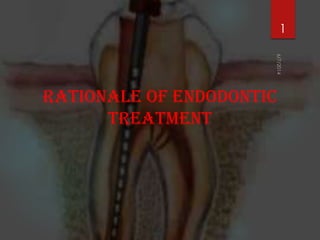 RATIONALE OF ENDODONTIC
TREATMENT
1
 
