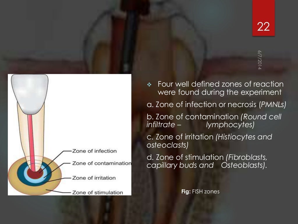 Rationals of endodontics best ppt