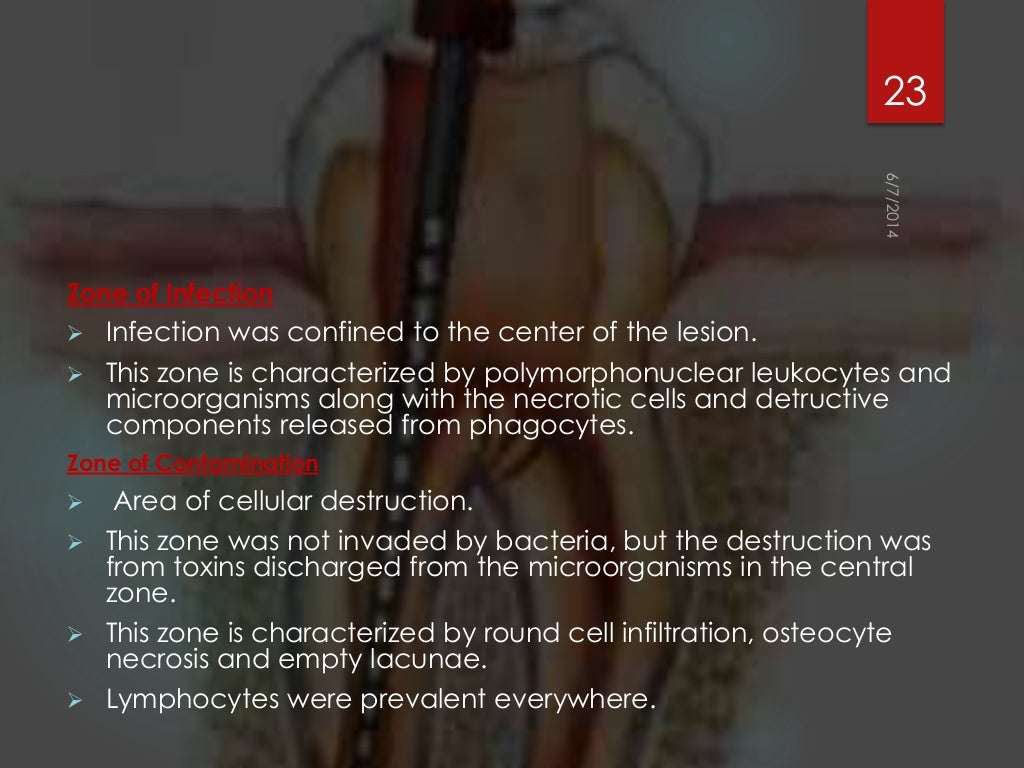 Rationals of endodontics best ppt