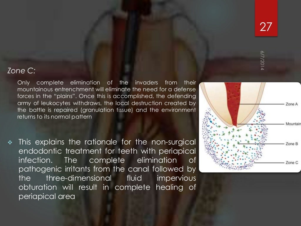 Rationals of endodontics best ppt