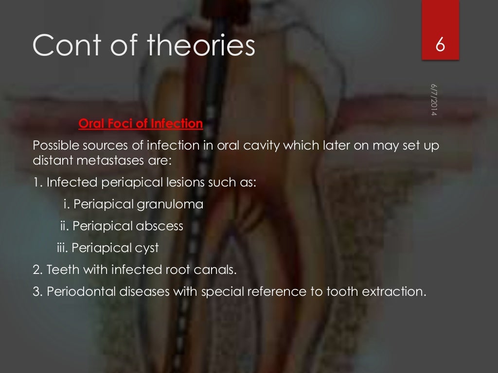 Rationals of endodontics best ppt