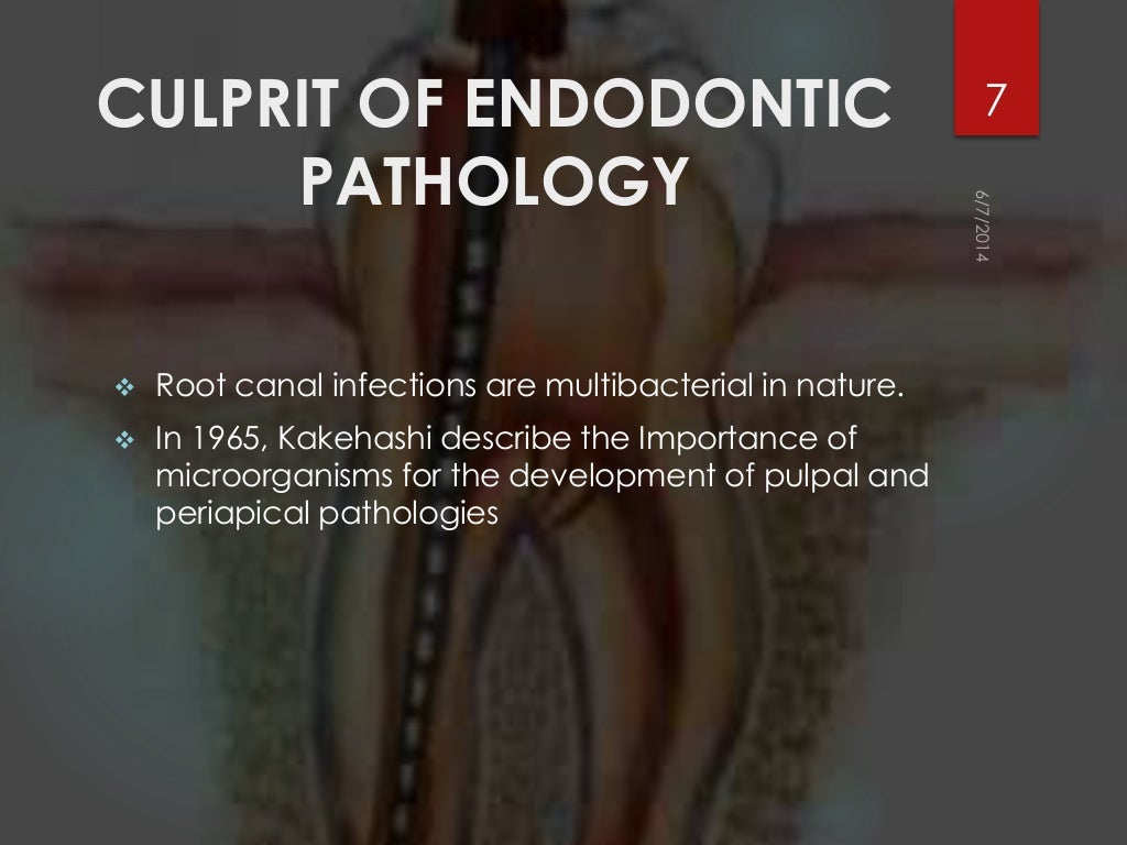 Rationals of endodontics best ppt