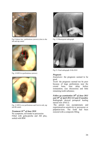 Endo protocols | PDF