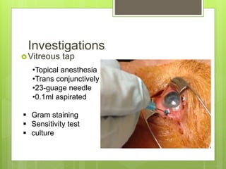 Investigations
Vitreous tap
•Topical anesthesia
•Trans conjunctively
•23-guage needle
•0.1ml aspirated
 Gram staining
 Sensitivity test
 culture
 