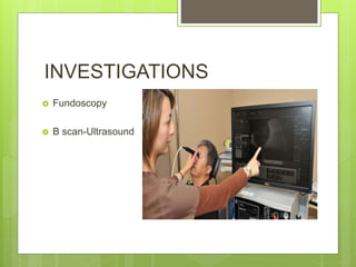 INVESTIGATIONS
 Fundoscopy
 B scan-Ultrasound
 