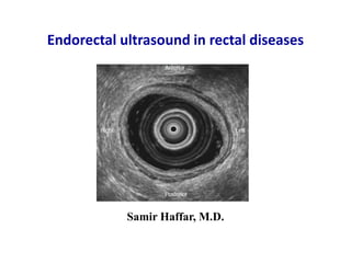 Samir Haffar, M.D.
Endorectal ultrasound in rectal diseases
 