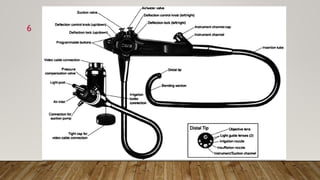 endoscopy | PDF