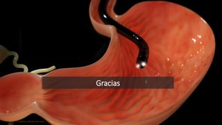 Gracias
Creditos: Keokimed.com
 