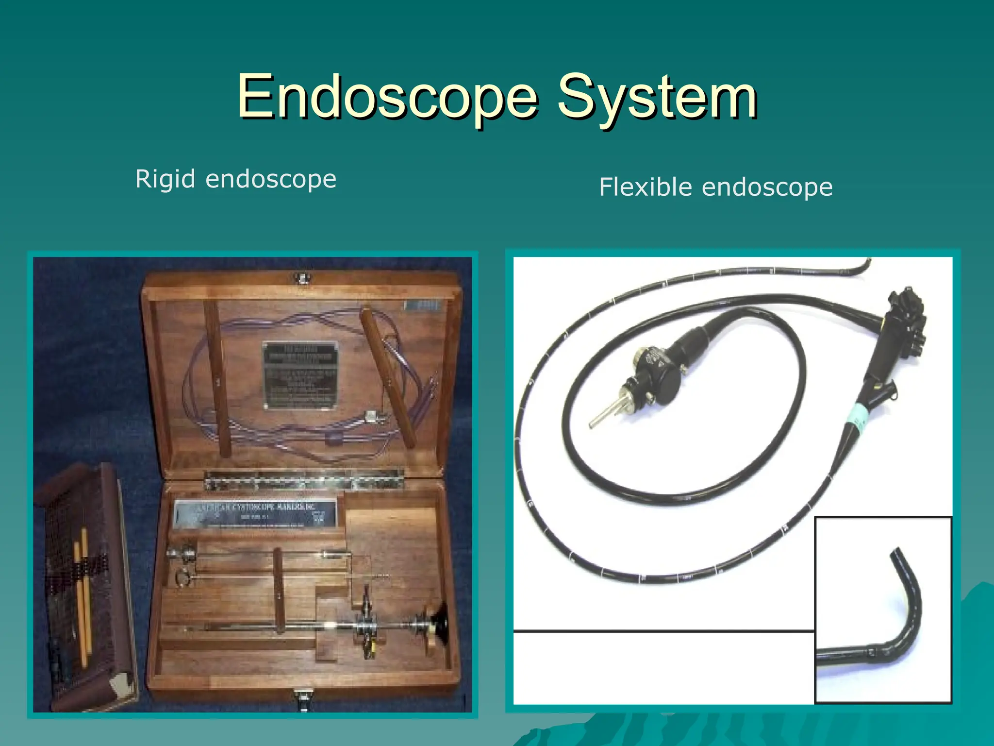 Endoscope System
Endoscope System
Rigid endoscope Flexible endoscope
 