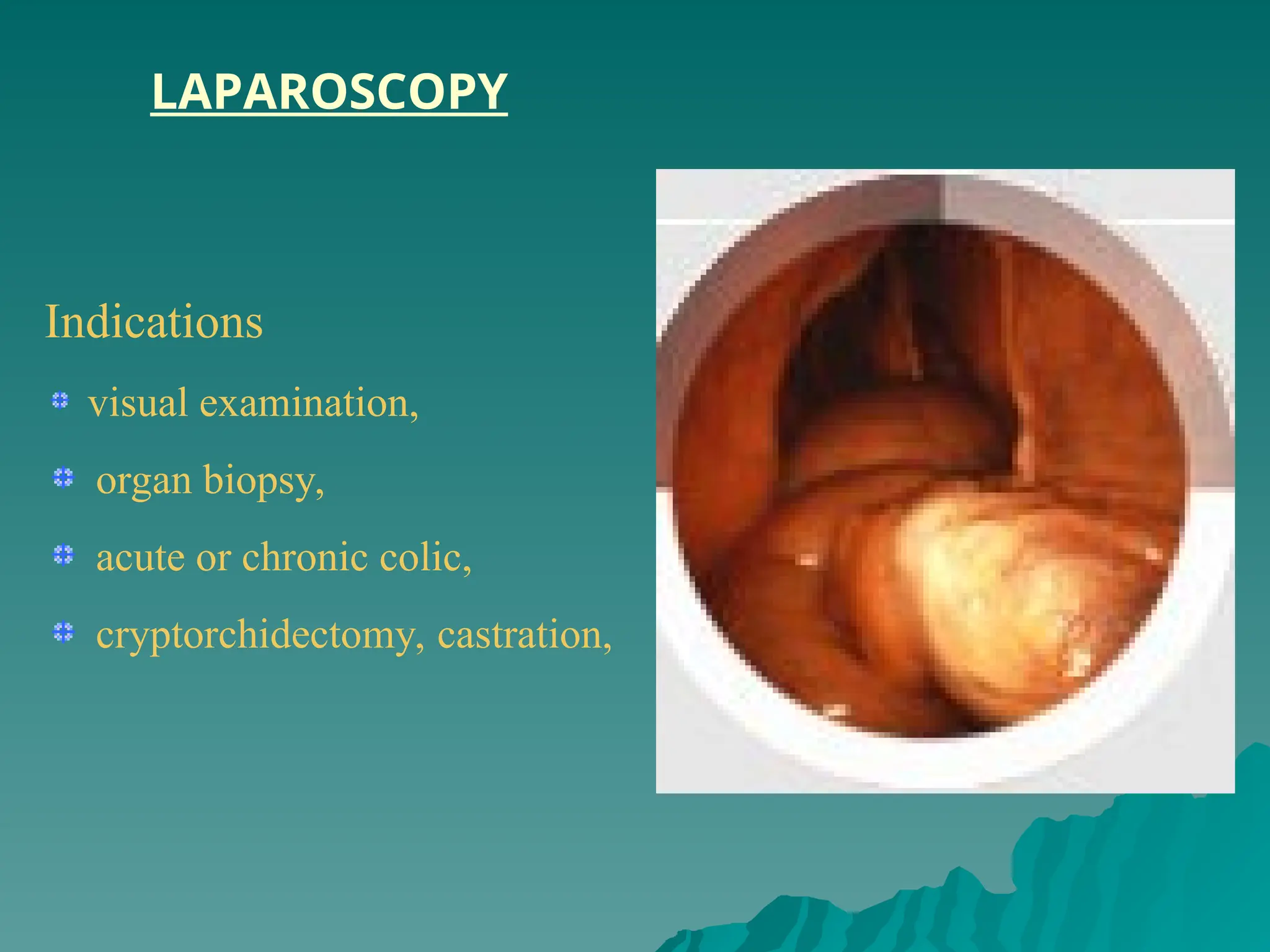 Indications
visual examination,
organ biopsy,
acute or chronic colic,
cryptorchidectomy, castration,
LAPAROSCOPY
 