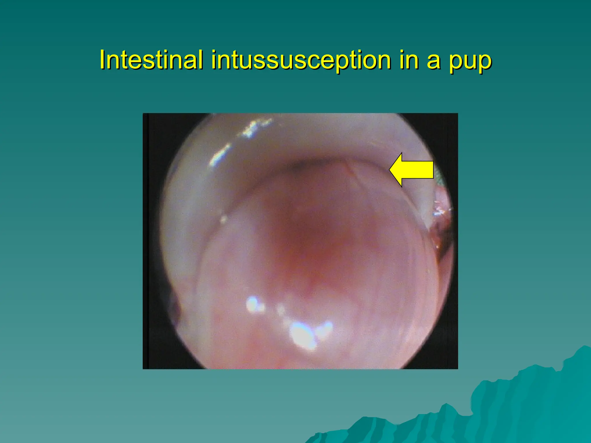 Intestinal intussusception in a pup
Intestinal intussusception in a pup
 
