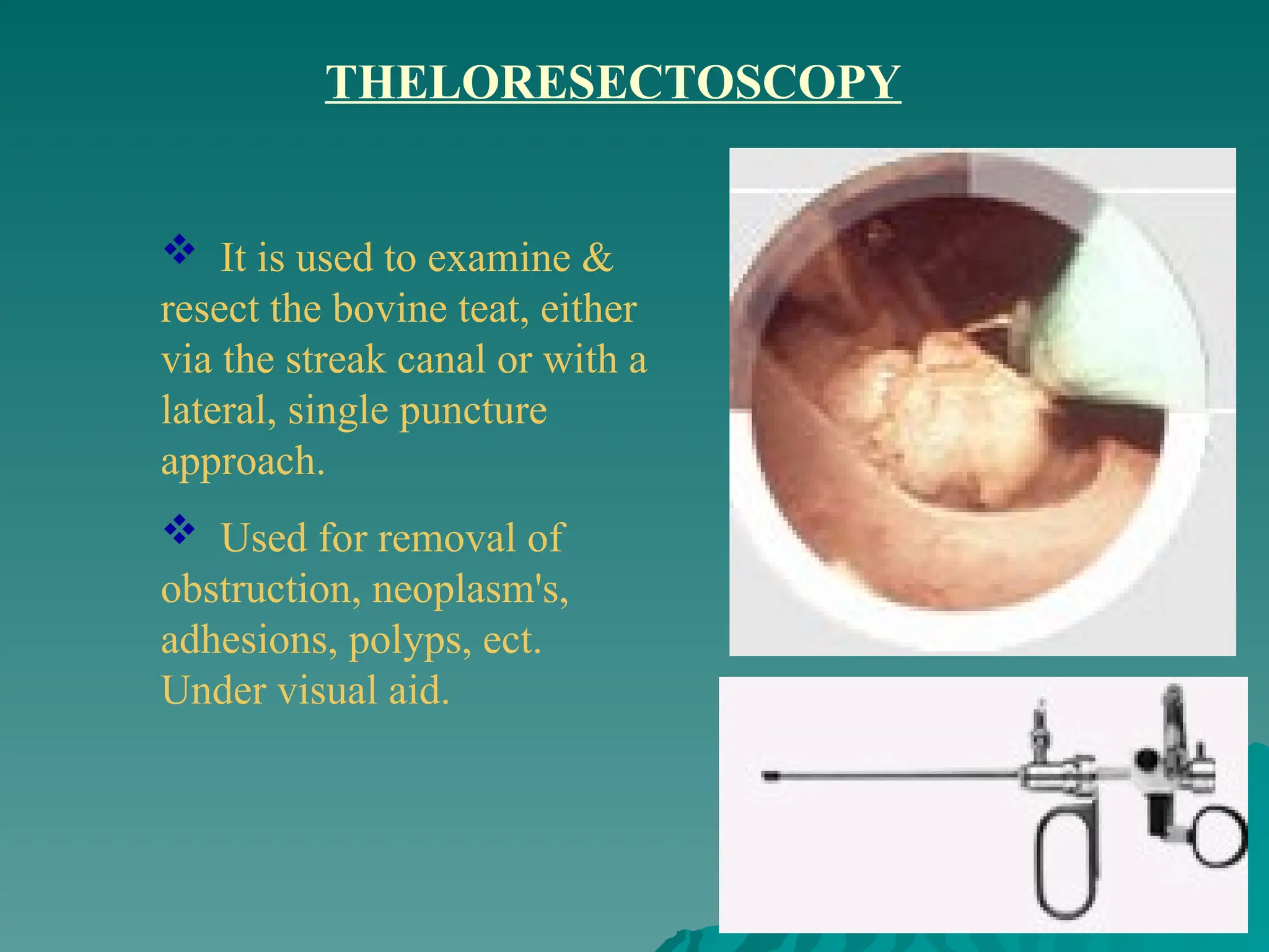  It is used to examine &
resect the bovine teat, either
via the streak canal or with a
lateral, single puncture
approach.
 Used for removal of
obstruction, neoplasm's,
adhesions, polyps, ect.
Under visual aid.
THELORESECTOSCOPY
 