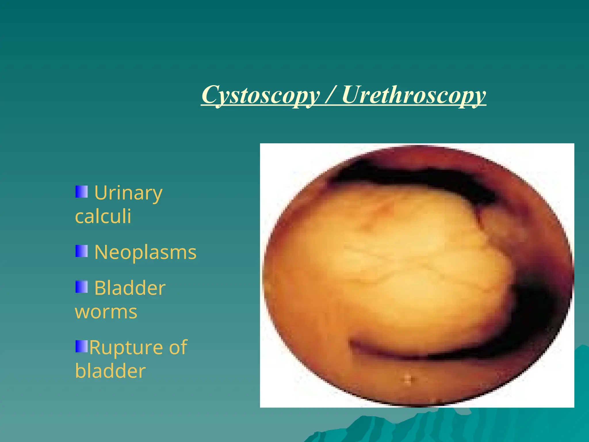 Cystoscopy / Urethroscopy
Urinary
calculi
Neoplasms
Bladder
worms
Rupture of
bladder
 