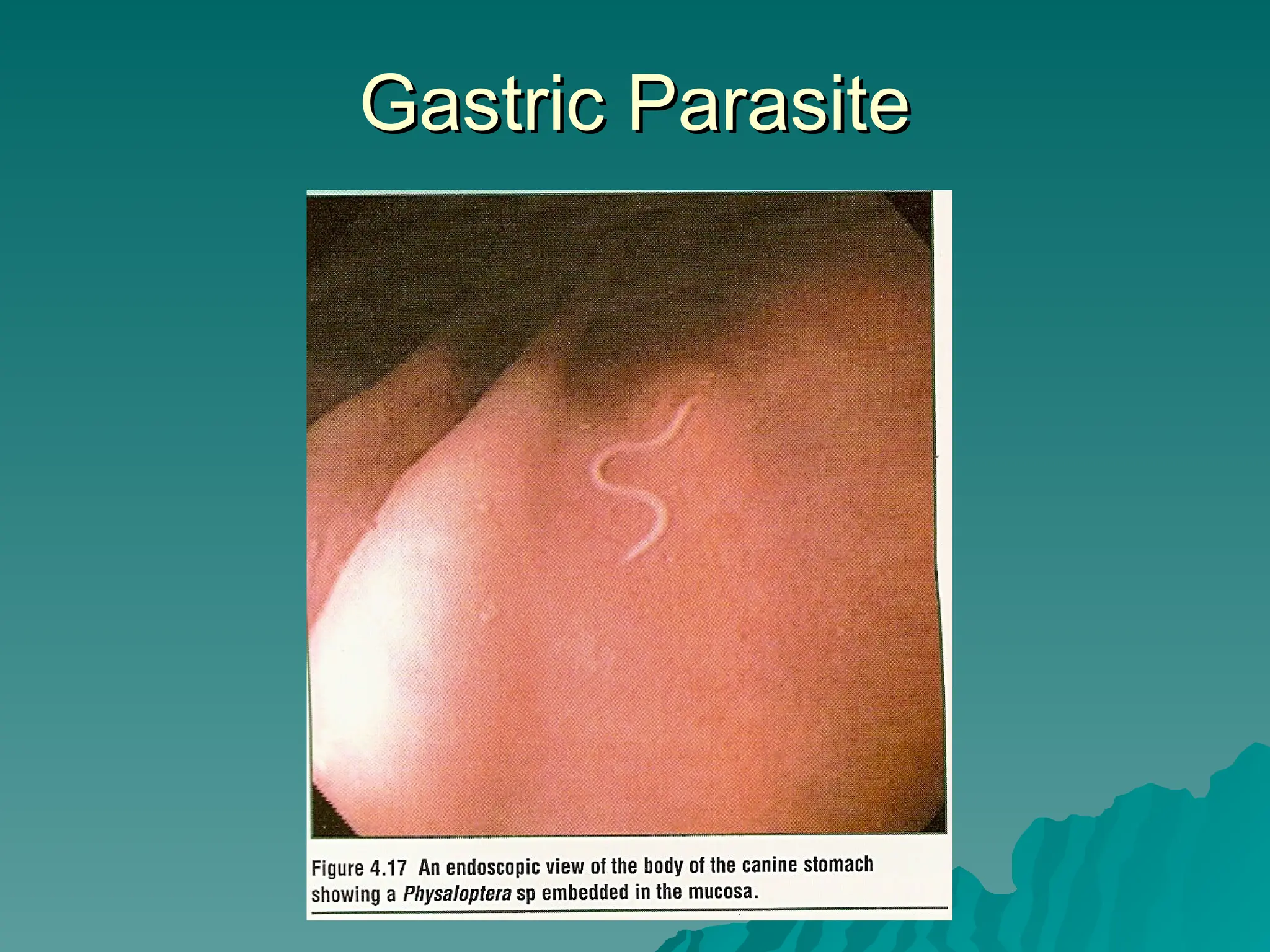 Gastric Parasite
Gastric Parasite
 
