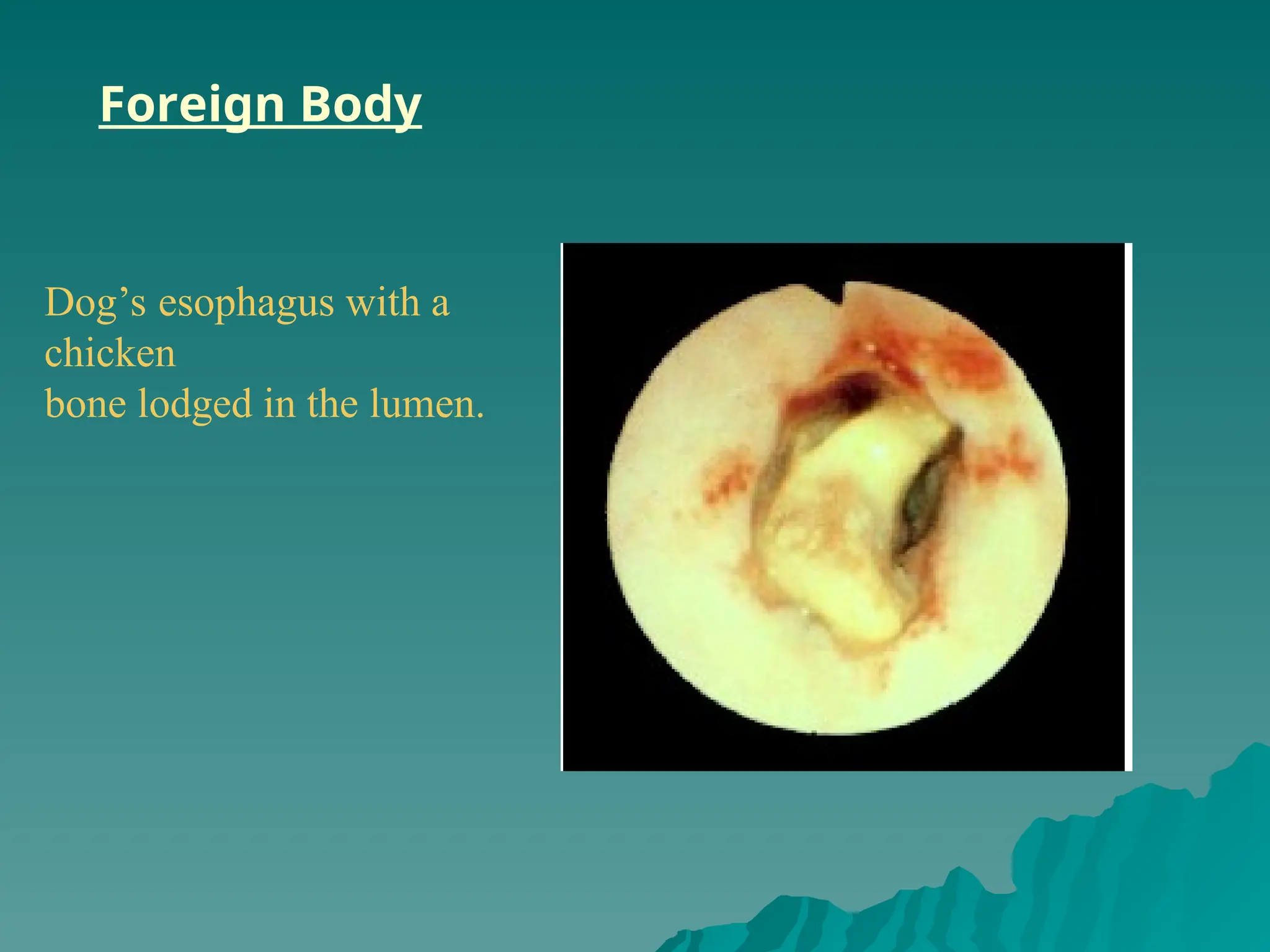 Foreign Body
Dog’s esophagus with a
chicken
bone lodged in the lumen.
 