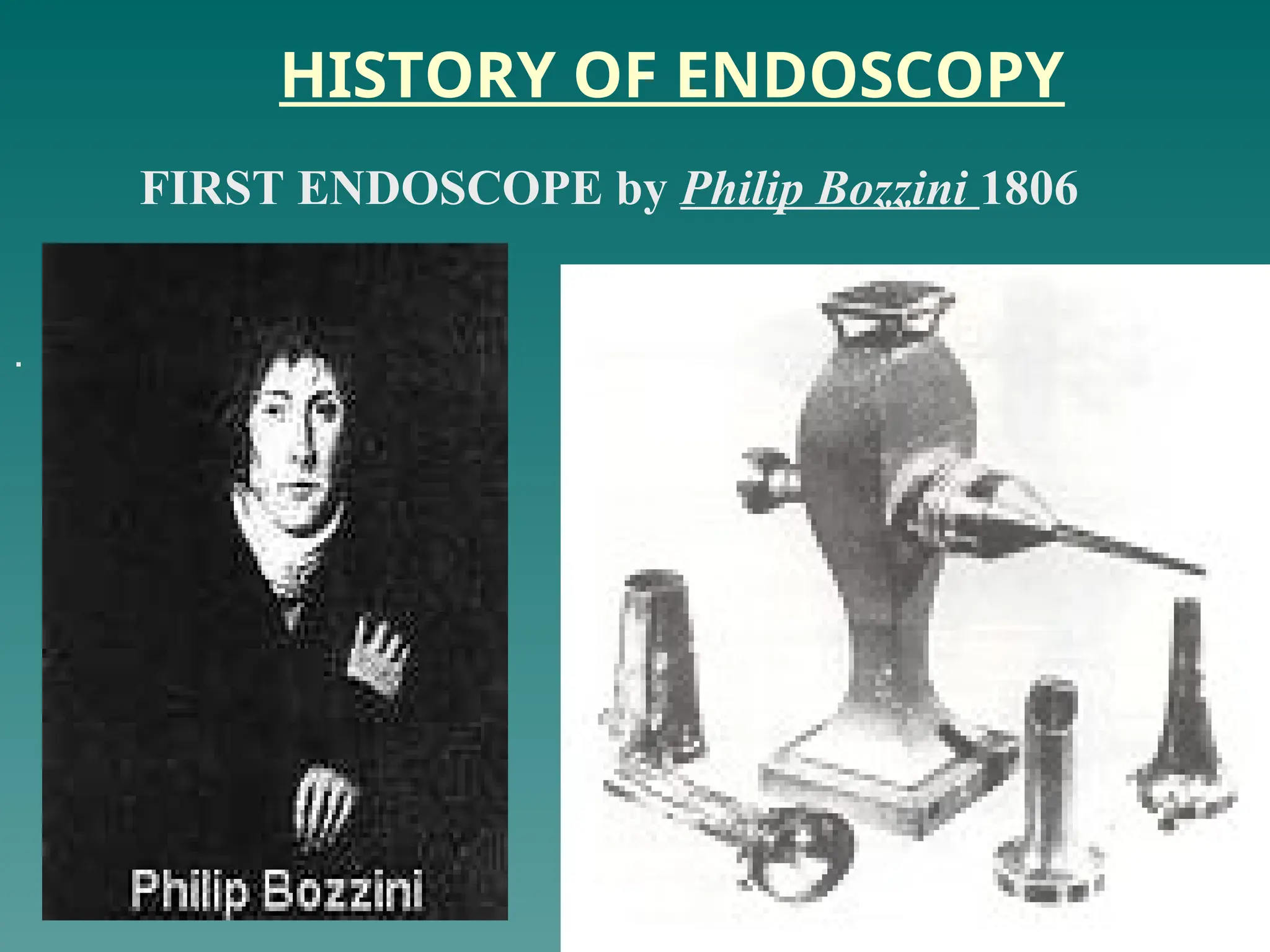 HISTORY OF ENDOSCOPY
.
FIRST ENDOSCOPE by Philip Bozzini 1806
 