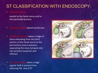 Endoscope assisted middle ear surgery | PPTX
