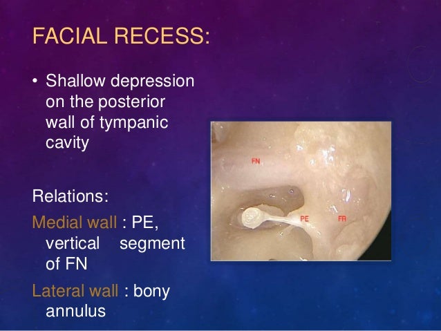 Endoscope assisted middle ear surgery