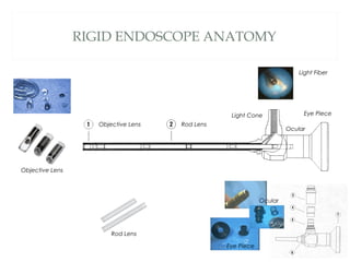 RIGID ENDOSCOPE ANATOMY
Objective Lens
Objective Lens
Light Fiber
Rod Lens
Ocular
Ocular
Eye Piece
Eye Piece
Rod Lens
Light Cone
 