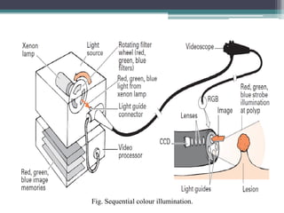 Endoscopes - Biomedical Engineering | PDF