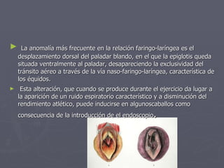 La anomalía más frecuente en la relación faringo-laríngea es el desplazamiento dorsal del paladar blando, en el que la epiglotis queda situada ventralmente al paladar, desapareciendo la exclusividad del tránsito aéreo a través de la vía naso-faringo-laríngea, característica de los équidos. Esta alteración, que cuando se produce durante el ejercicio da lugar a la aparición de un ruido espiratorio característico y a disminución del rendimiento atlético, puede inducirse en algunoscaballos como consecuencia de la introducción de el endoscopio . 