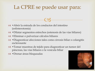 
 •Abrir la entrada de los conductos del intestino
(esfinterotomía)
 •Dilatar segmentos estrechos (estenosis de las vías biliares)
 •Eliminar o pulverizar cálculos biliares
 •Diagnosticar afecciones tales como cirrosis biliar o colangitis
esclerosante
 •Tomar muestras de tejido para diagnosticar un tumor del
páncreas, las vías biliares o la vesícula biliar
 •Drenar áreas bloqueadas
La CPRE se puede usar para:
 