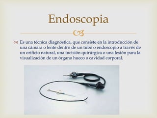 
 Es una técnica diagnóstica, que consiste en la introducción de
una cámara o lente dentro de un tubo o endoscopio a través de
un orificio natural, una incisión quirúrgica o una lesión para la
visualización de un órgano hueco o cavidad corporal.
Endoscopia
 