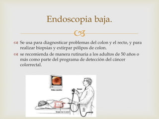 
 Se usa para diagnosticar problemas del colon y el recto, y para
realizar biopsias y extirpar pólipos de colon.
 se recomienda de manera rutinaria a los adultos de 50 años o
más como parte del programa de detección del cáncer
colorrectal.
Endoscopia baja.
 