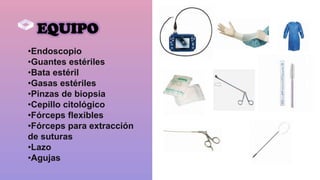 EQUIPO
•Endoscopio
•Guantes estériles
•Bata estéril
•Gasas estériles
•Pinzas de biopsia
•Cepillo citológico
•Fórceps flexibles
•Fórceps para extracción
de suturas
•Lazo
•Agujas
 