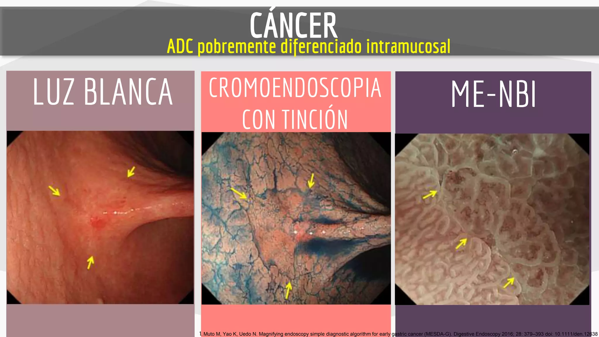 Endoscopia Normal Endoscopia avanzada gastrica | PPT