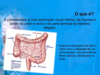 O que é?
A colonoscopia é uma exploração visual interna, da mucosa e
lúmen do cólon e recto e da parte terminal do intestino
delgado.

 Exame endoscópico de todo o
cólon com a utilização de um
colonoscópio, tubo provido de
fibras ópticas, introduzido no
recto.

 