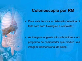 Colonoscopia por RM
 Com esta técnica a distensão intestinal é
feita com soro fisiológico e contraste;

 As imagens originais são submetidas a um
programa de computador que produz uma

imagem tridimensional do cólon.

 