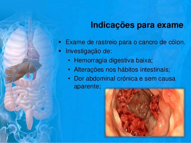Procedimento para fazer exame de colonoscopia