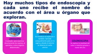 Hay muchos tipos de endoscopia y
cada uno recibe el nombre de
acuerdo con el área u órgano que
exploran.
LAPARASCOPIA
Empleado para examinar
directamente los ovarios, el
apéndice u otros órganos
abdominales.
COLPOSCOPIA
Se introduce el espéculo o
también llamado
coloquialmente pato en la
vagina y desde el exterior
se observa el cuello
uterino
COLONOSCOPIA
Se explora la totalidad del
colon e intestino grueso a
travez del ano
 