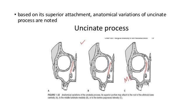 Endoscopic anatomy of ethmoid bone