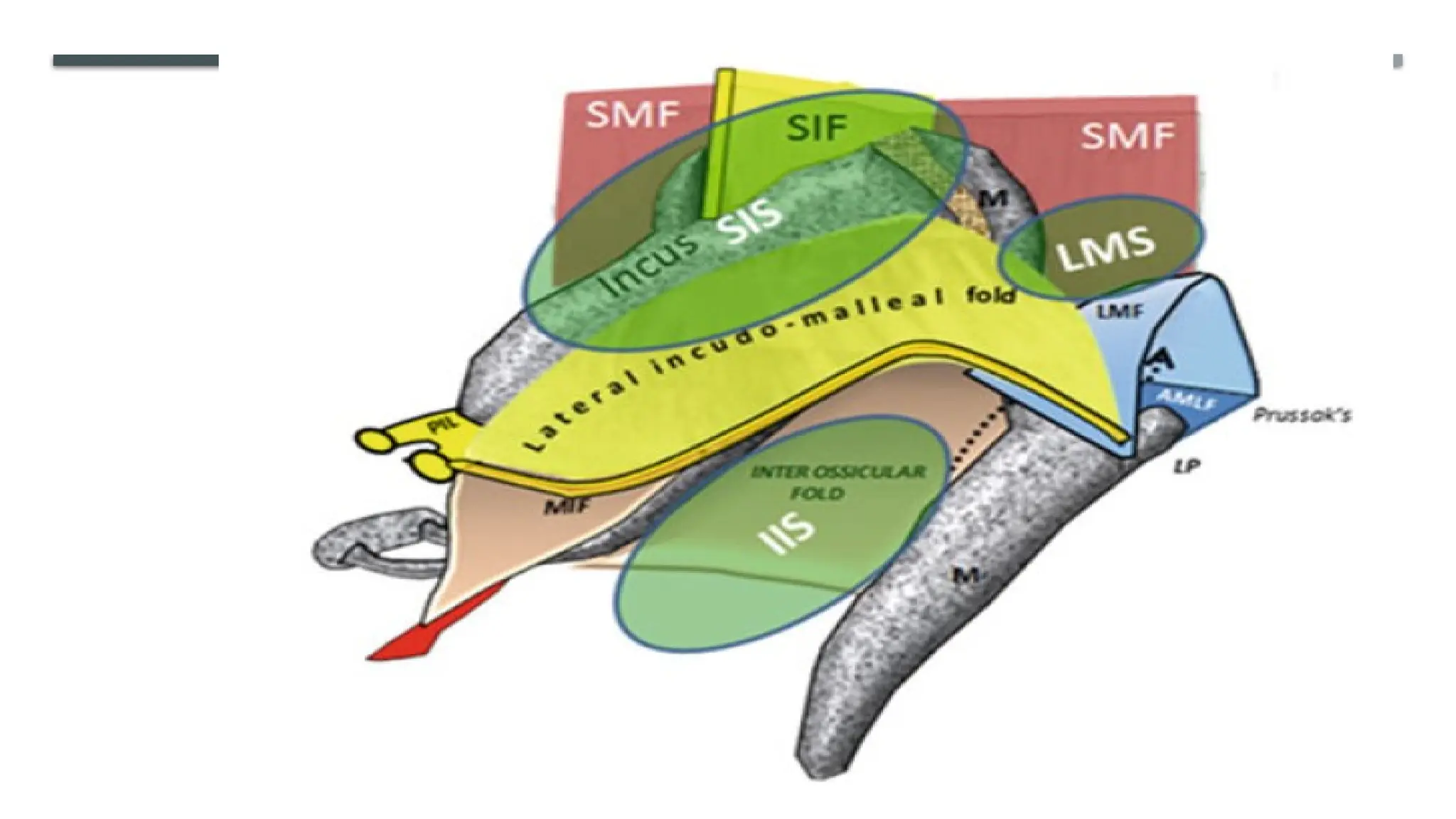 ENDOSCOPIC ANATOMY OF MIDDLE EAR CLEFT AND MUCOSAL FOLDS.pptx
