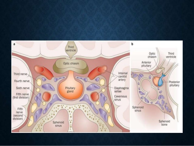 proper for test thyroid Endoscopic wall of anatomy sphenoid of lateral sinus