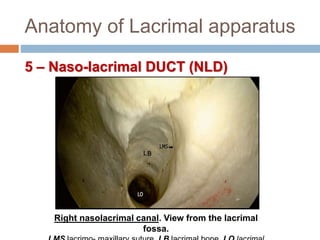 Anatomy of Lacrimal apparatus
5 – Naso-lacrimal DUCT (NLD)
Right nasolacrimal canal. View from the lacrimal
fossa.
 