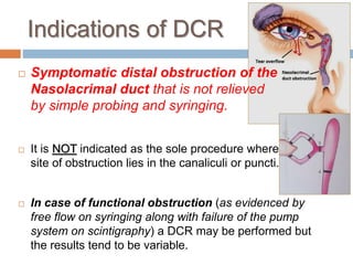Indications of DCR
 Symptomatic distal obstruction of the
Nasolacrimal duct that is not relieved
by simple probing and syringing.
 It is NOT indicated as the sole procedure where the
site of obstruction lies in the canaliculi or puncti.
 In case of functional obstruction (as evidenced by
free flow on syringing along with failure of the pump
system on scintigraphy) a DCR may be performed but
the results tend to be variable.
 