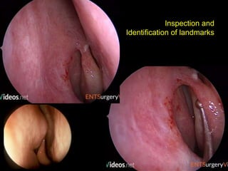 Inspection and
Identification of landmarks
 