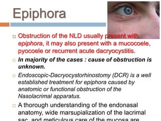  Obstruction of the NLD usually present with
epiphora, it may also present with a mucocoele,
pyocoele or recurrent acute dacryocystitis.
 In majority of the cases : cause of obstruction is
unknown.
 Endoscopic-Dacryocystorhinostomy (DCR) is a well
established treatment for epiphora caused by
anatomic or functional obstruction of the
Nasolacrimal apparatus.
 A thorough understanding of the endonasal
anatomy, wide marsupialization of the lacrimal
Epiphora
 