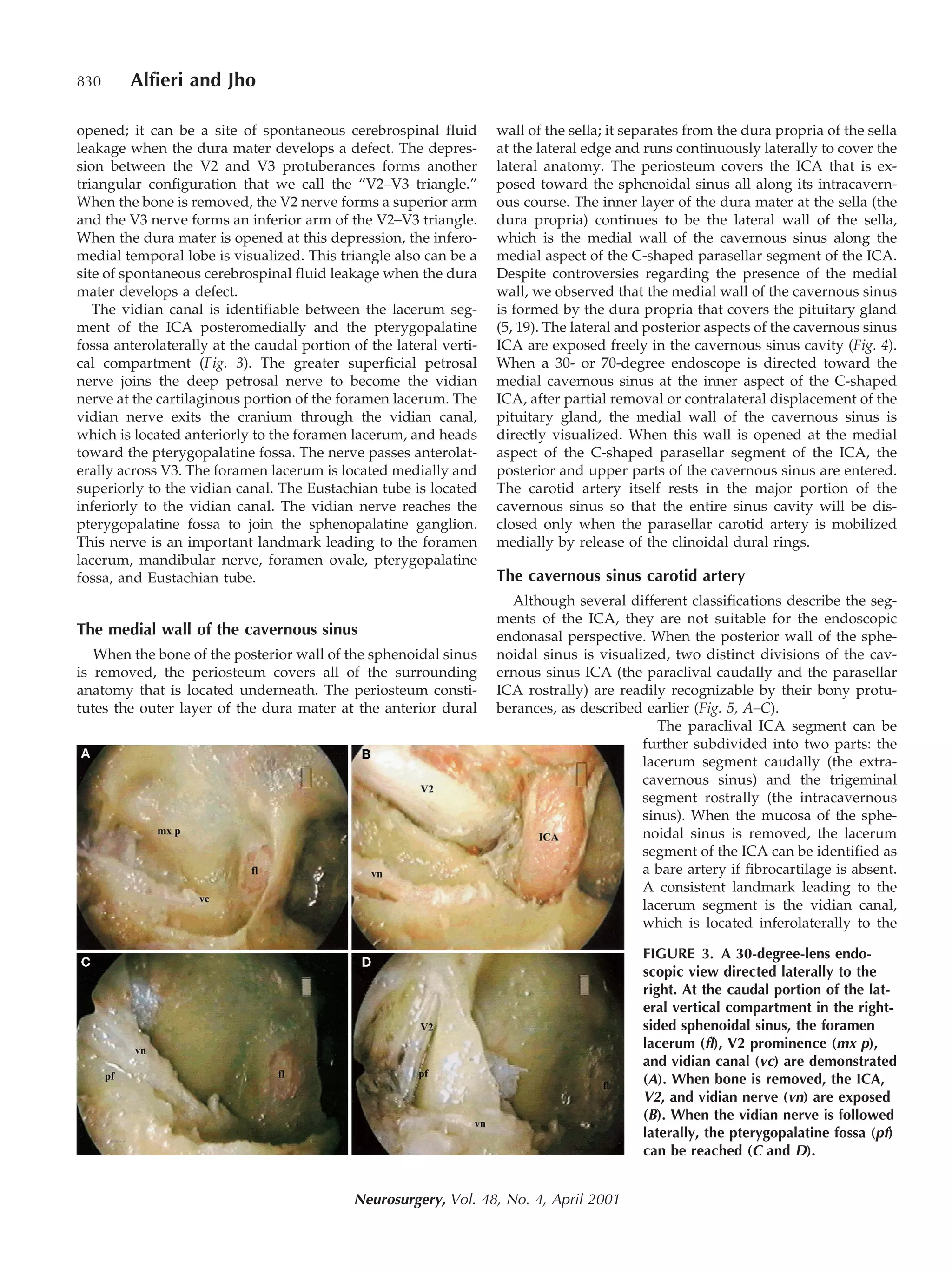 Endoscopic endonasal cavernous sinus surgery: An Anatomic study | PDF