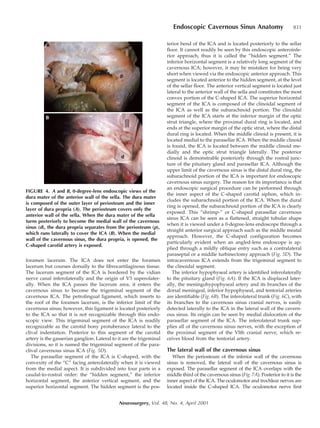 Endoscopic endonasal cavernous sinus surgery: An Anatomic study | PDF