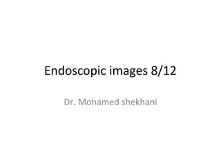 Endoscopic images 8/12

   Dr. Mohamed shekhani
 